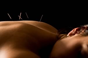 acupuncture hamilton